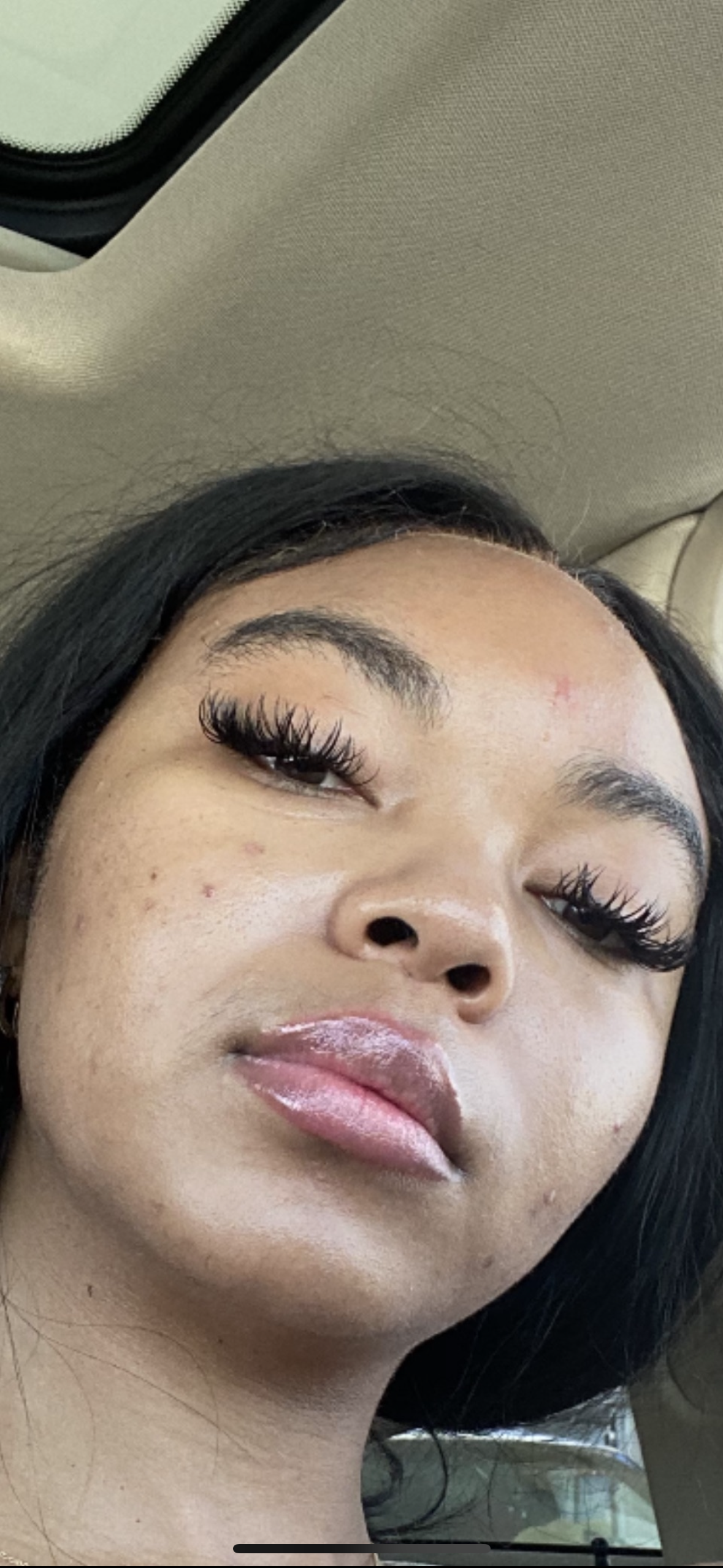 Before: Model suffered from mild acne