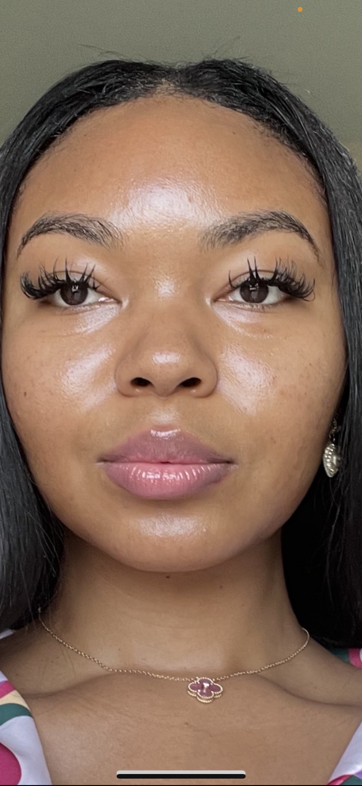 After: Model using our facial serum for one month.